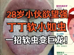 裂纹加苔厚腻，丁丁必会弱小如虫难以站立，李大夫让你软虫变巨龙！