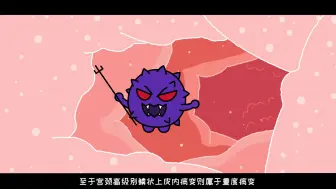 宫颈癌出现的前兆——宫颈癌与它的宿敌（第四集）复旦大学附属妇产科医院出品 有字幕