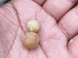 今年凤眼菩提成熟的季节推迟了，还得15-30天