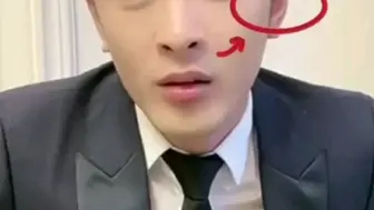 轮飞廓反的耳朵是什么耳朵？