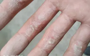 那个引体真的是背不痛，手痛，老茧子都磨烂了。。。
