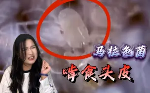 马拉色菌啃食头皮？！