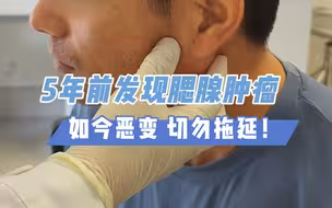 5年前发现肿瘤如今恶变，切勿拖延！