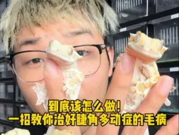 睫角的多动症到底该怎么治！一招教你解决