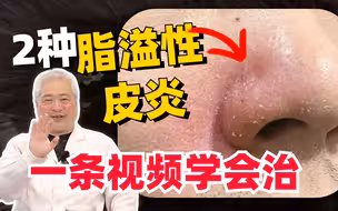 【科普】一次性教你处理，两种脂溢性皮炎！
