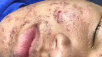 人体矿脉 204