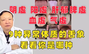 阴虚，阳虚，肝郁，脾虚，血虚，气虚9种异常体质的舌象，看看你是哪种？