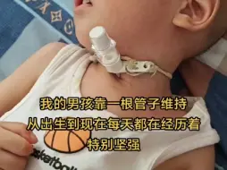 我的男孩因肌无力在重症监护室躺了七个月，做了气管切开，目前插着管子维持，感恩所有的善缘，可以为宝宝说句加油吗