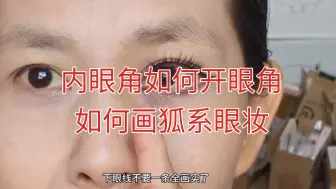 如何用双眼皮开眼角