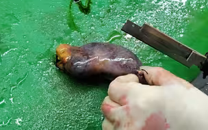胆管癌的胆囊，已无保留意义！作为恶性度极高的癌症，胆管癌极易早期就转移，所以胆囊必须第一时间切除！