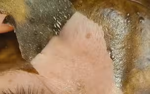 毛孔清洁，一颗颗拔出来