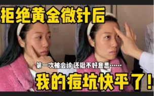 第8次治痘坑|沉浸式全程记录vlog(上）