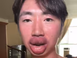 关于我吃小龙虾嘴肿了这件事