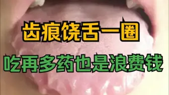 齿痕饶舌一圈，吃再多二陈丸也是浪费钱！把这打通了，几块钱就能搞定！