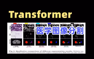 Transformer跨界做医学图像分割 ！从未见过如此通俗易懂的深度学习实战教程，论文精读+代码复现，讲得太透彻了！！注意力机制|图像分割|深度学习|人工智能