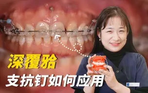支抗钉VS错颌畸形！MIA支抗技术解决重度深覆合的需要几个步骤？