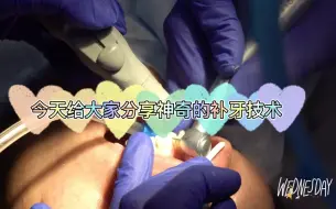 神奇的补牙技术