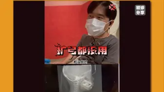 扩弓不是万能钥匙，尤其遇上这种情况！