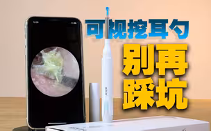 好用归好用！但是坑也真不少！西圣Find可视挖耳勺体验分享！