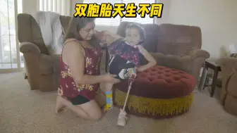 连体双胞胎共享身体和器官，手术变成残疾人，每人佩戴一只假肢 #纪录片