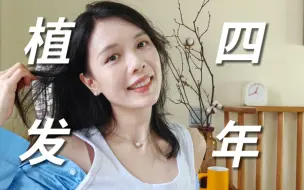四年前我去植了发，现在怎么样了？