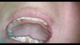 很轻松就拔除松动又疼痛的牙齿！