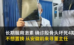 “您是我最后的希望”，确诊股骨头坏死4期，年轻不想置换，从安徽前来寻董主任！