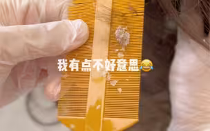 一位头皮有问题的小姐姐来做护理！
