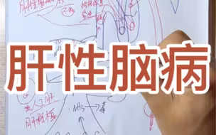 肝性脑病，祝大家身体健康！