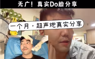 真实分享～超声炮值得做吗