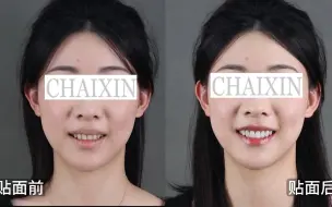 牙齿对顔值的影响到底有多大？