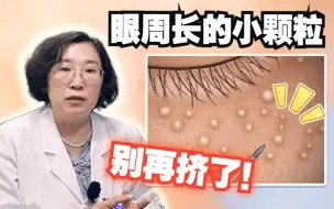 眼周长了脂肪粒别再自己挤了！皮肤科医生教你正确处理