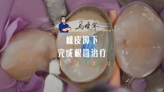 假壁完事然后根充，用的生物陶瓷，OK。