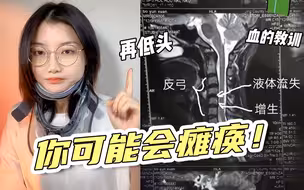 【颈椎疼必看！】3年颈椎病经历！手麻头晕要谨慎！必学4个缓解方法！