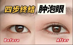 【唐毅】画过1000双肿泡眼后，总结的消肿4步曲。肿内变大双～无双眼皮贴内附