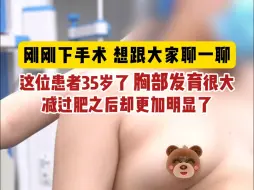 男子胸部发育，减肥之后更加明显