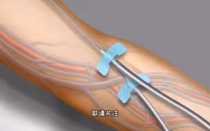 输液为什么用静脉而不用动脉，3D演示。。